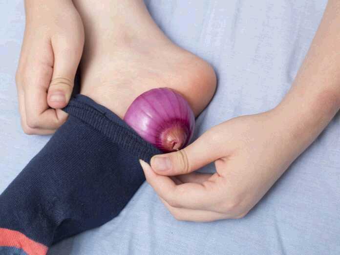 onions in your socks help fight the flu