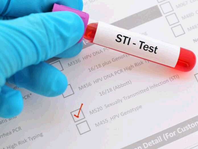 facts about STI testing