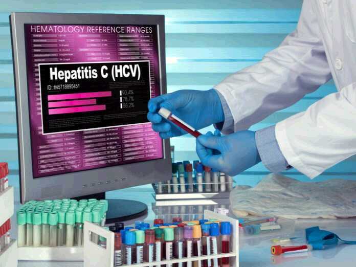 hepatitis C tests